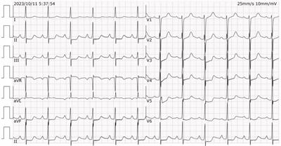 Case report: Near-fatal hypermagnesemia resulting from the use of Epsom salts in a patient with normal renal function